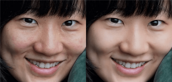 SkinFiner4下载