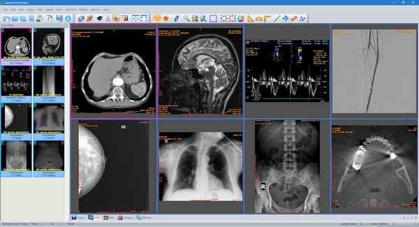 【sante dicom editor激活版下载】sante dicom editor激活版(DICOM编辑器) v7.8.6 免费版
